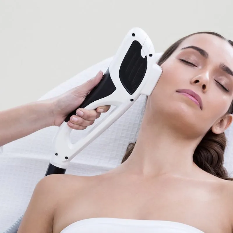 Traitement IPL lumière pulsée pour le rajeunissement du visage
